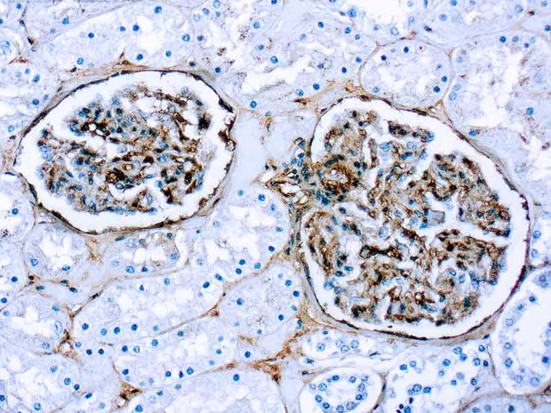 Immunohistochemistry (Formalin/PFA-fixed paraffin-embedded sections) analysis of human kidney tissue labelling Fibronectin with ab2413 at 1/50 dilution.