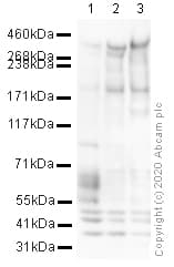 Anti-MAP2 antibody - Neuronal Marker(AB32454)