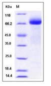 Recombinant Human ADAM15 protein (His tag)(AB276288)