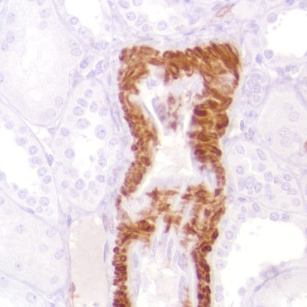 Anti-Calponin 1 antibody [SP180] - C-terminal(AB227660)