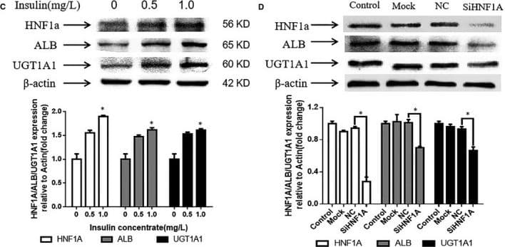 Anti-UGT1A1 antibody [EPR9592](AB170858)