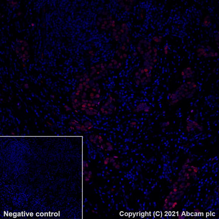 Alexa Fluor® 555 Anti-Estrogen Receptor alpha antibody [SP1](AB282199)