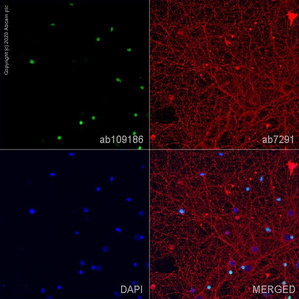 Olig2 staining in primary hippocampal rat neurons/glia, DIV14, showing cell morphology, nuclear DNA, and protein localization.