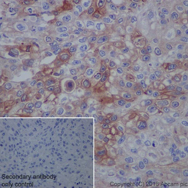 Anti-Uroplakin II/UPII antibody [EPR18799] - BSA and Azide free(AB224261)