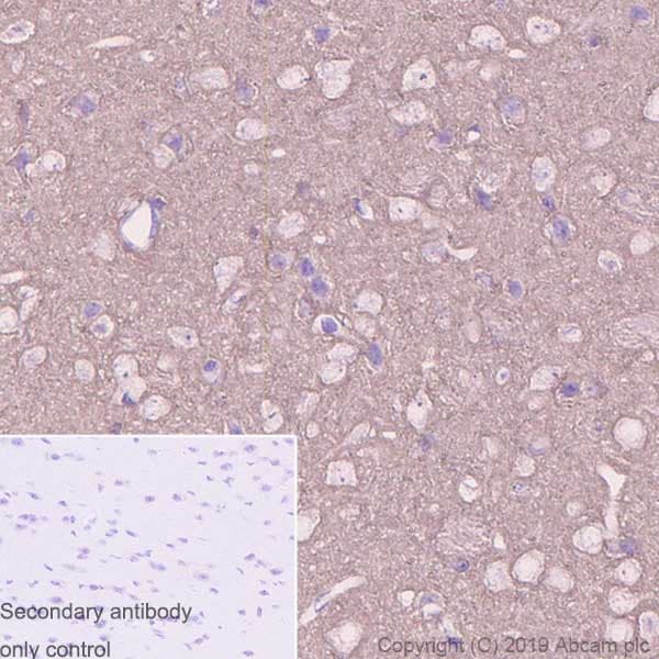 Anti-beta Synuclein antibody [EP1537Y] - BSA and Azide free(AB221908)