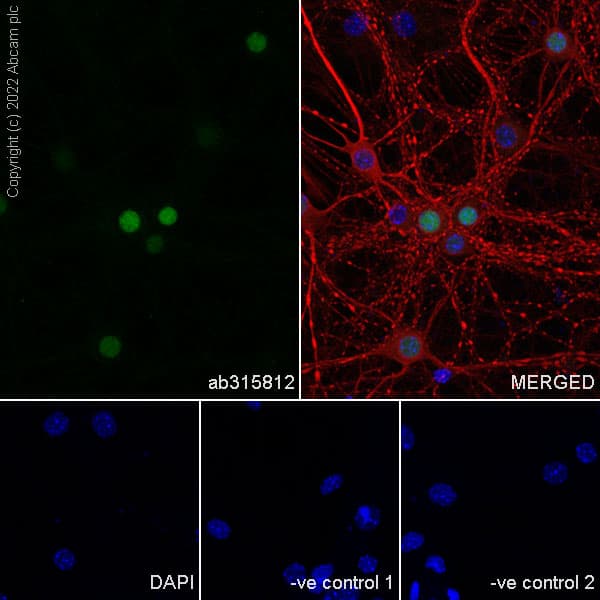 Anti-MATH2/NEUROD6 antibody [EPR28660-23](AB315812)