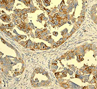 Anti-CXCR4 antibody [UMB2](AB124824)