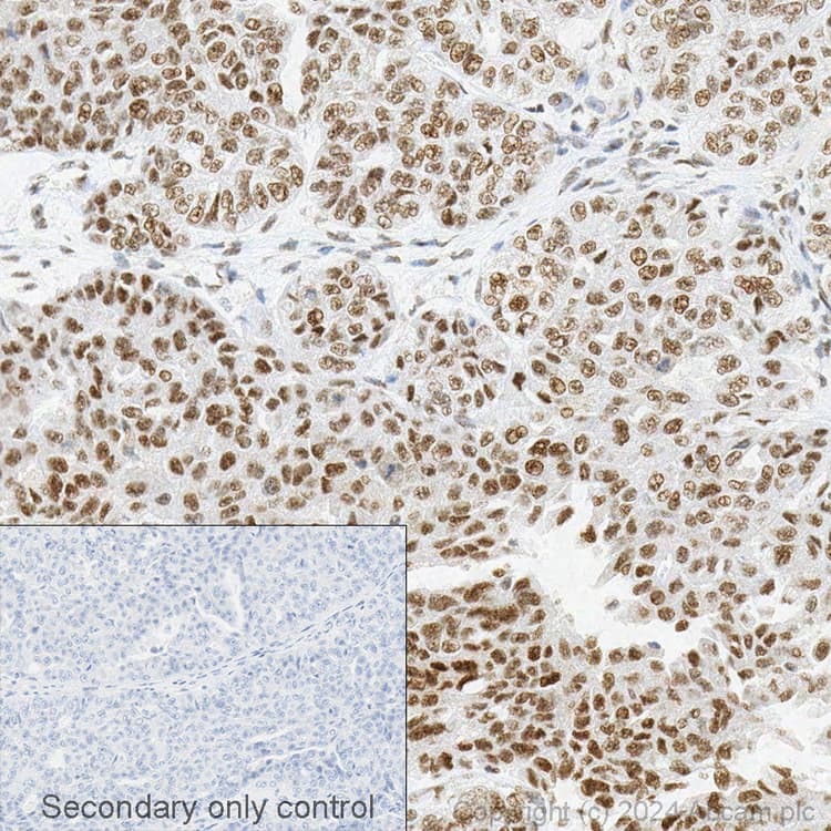 Anti-METTL3 antibody [EPR18810](AB195352)