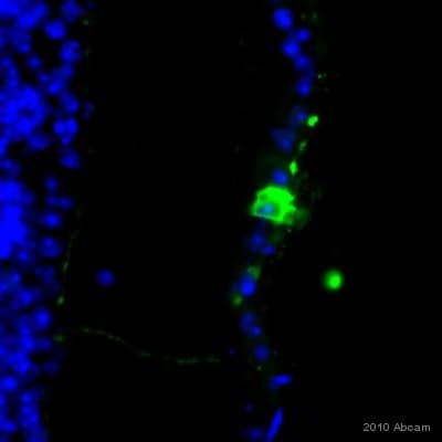 Anti-beta Galactosidase antibody(AB9361)
