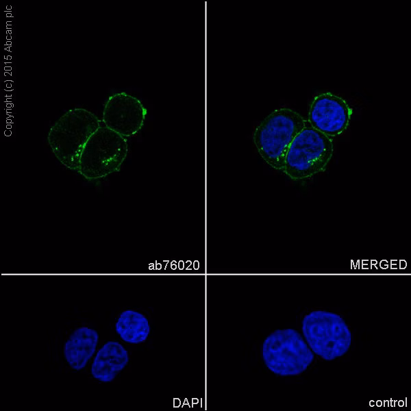 Immunofluorescence staining of MCF-7 breast cancer cells showing Sodium Potassium ATPase (green) and nuclei (blue).