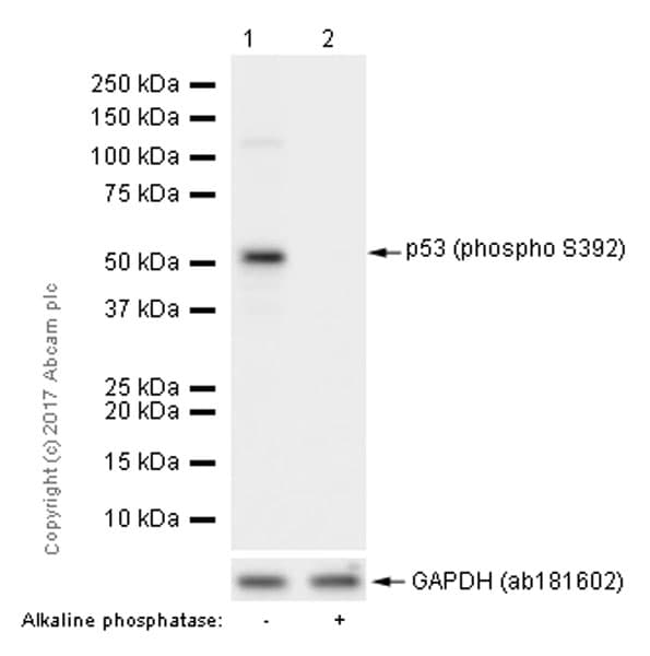 Anti-p53 (phospho S392) antibody [EP155Y] - BSA and Azide free(ab239211)