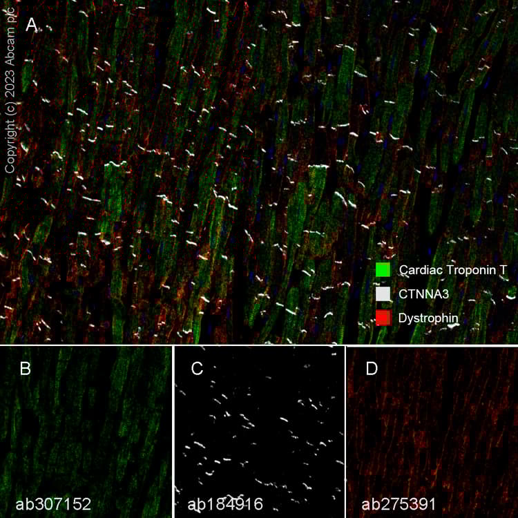 Anti-Dystrophin antibody [EPR23336-129](AB275391)