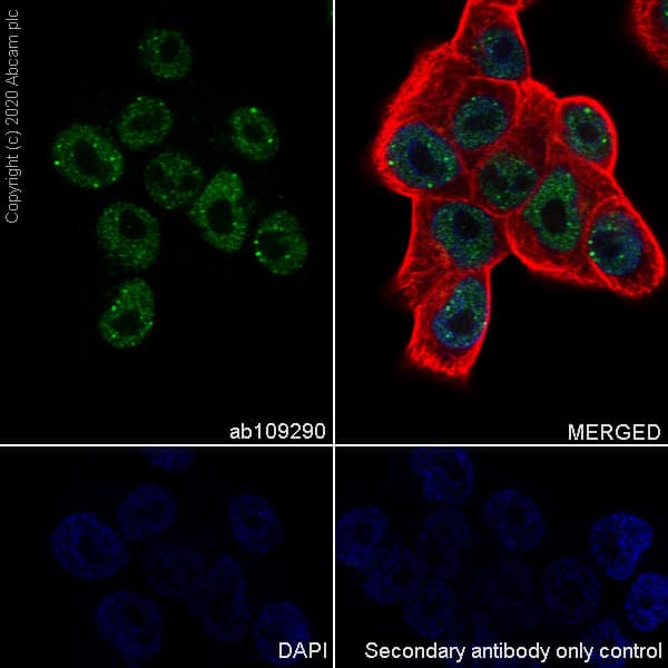 Sox1 Antibody Epr4766 Ab109290  Immunocytochemistry Immunofluorescence Img165716