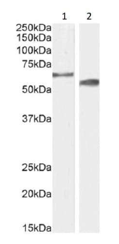 Anti-CYP2R1 antibody(ab239217)