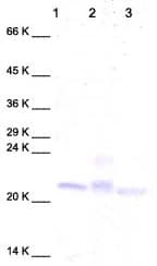 Anti-TIMP3 antibody(AB39184)