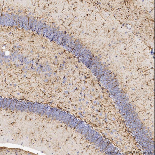 IHC image of GFAP staining in normal mouse brain tissue
