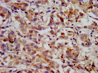 Hmgcs2 Antibody Ab236667  Immunohistochemistry Formalin Pfa Fixed Paraffin Embedded Sections Img93257