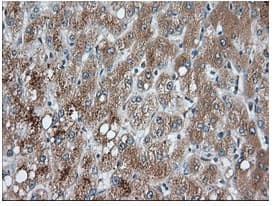 Pank2 Antibody Oti3h9 Ab119070  Immunohistochemistry Formalin Pfa Fixed Paraffin Embedded Sections Img113001