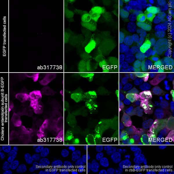 Cholera Enterotoxin Subunit B Antibody Epr27372 4 Ab317738  Immunocytochemistry Immunofluorescence Img432095
