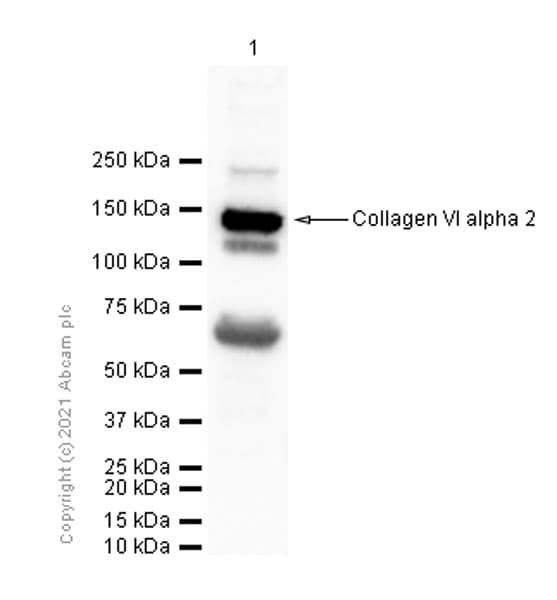 Anti-Collagen VI alpha 2 antibody [EPR7889(N)](AB180855)