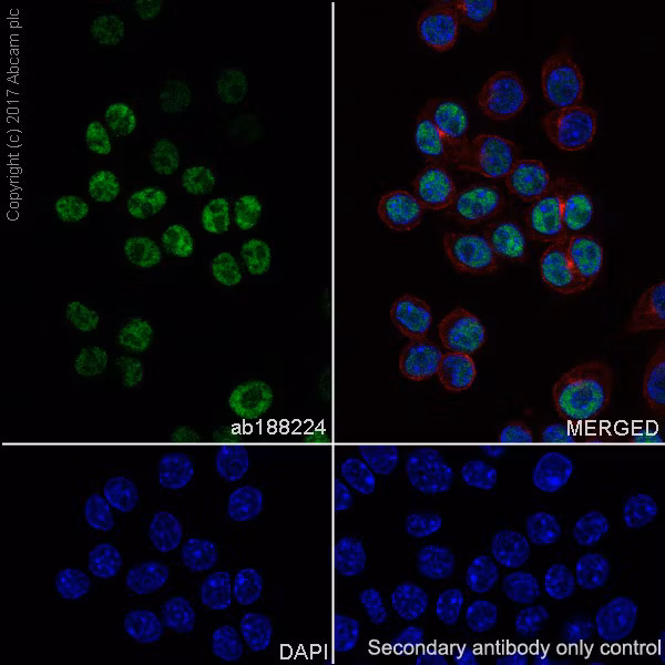 Confocal microscopy image of RAW264.7 cells showing blue nuclear staining with DAPI and red tubulin staining using anti-alpha Tubulin antibody (ab195889) at 1/200 dilution.