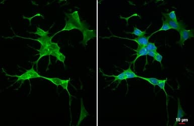Rgs4 Antibody Hl1522 Ab308160  Immunocytochemistry Immunofluorescence Img407037