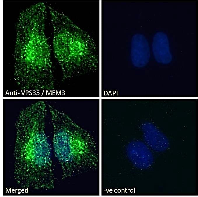 Anti-VPS35 antibody(AB10099)