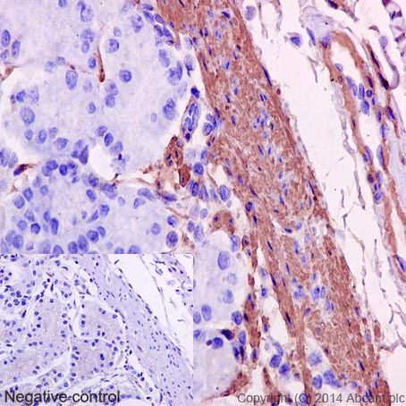 Immunohistochemistry of human stomach tissue labeling alpha smooth muscle Actin with antibody ab124964 at 1/1000
