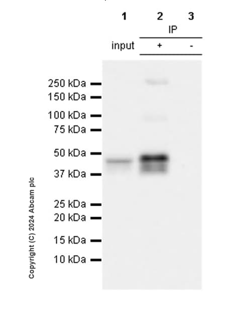 Anti-Pseudomonas Outer membrane porin F antibody [EPR28629-91](AB316973)