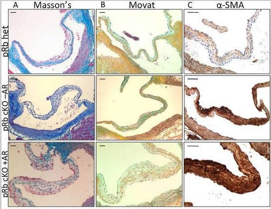 Representative histology of aortic valve leaflets from aged mice demonstrates changes in pRb cKO AoV
