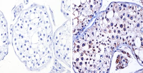 Anti-nNOS (neuronal) antibody(AB5586)