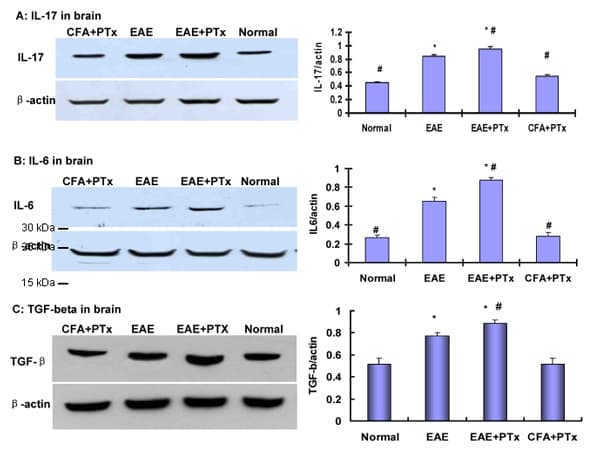 HRP Anti-beta Actin antibody [AC-15](AB49900)