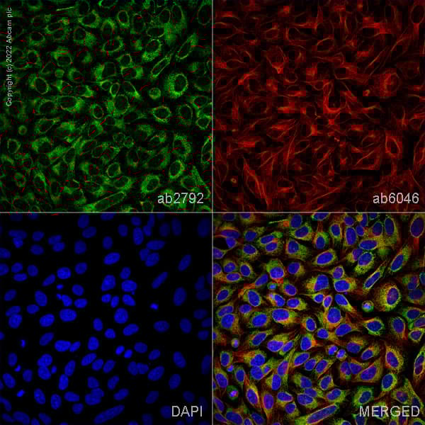 Anti-P4HB antibody [RL90](AB2792)