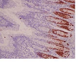 Immunohistochemistry analysis of paraffin-embedded rat colon tissue labeling SOX9 with ab185966 at 1/1000 dilution.