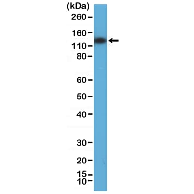 Anti-MSH3 antibody [RM405](AB275928)