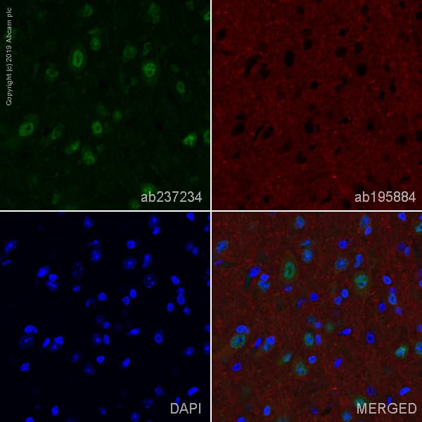 Alexa Fluor® 488 Anti-HuD + HuC antibody [EPR19098](AB237234)