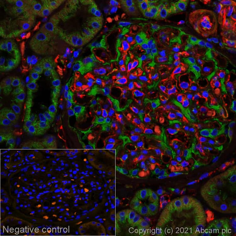 Alexa Fluor® 555 Anti-CD31 antibody [EPR3094](AB279331)