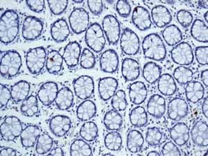 Cytochrome P450 4a Cyp4a11 Antibody Epr8276 Bsa And Azide Free Ab248918  Immunohistochemistry Formalin Pfa Fixed Paraffin Embedded Sections Img130184