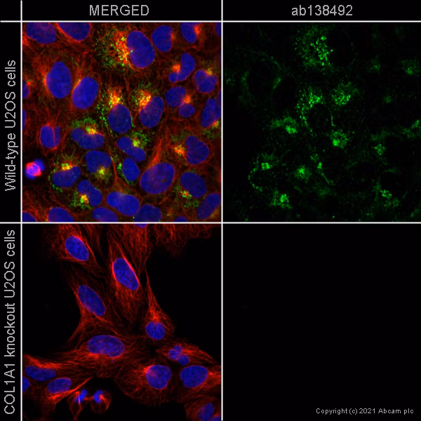 ab138492 staining Collagen alpha-1 chain in wild-type U2OS cells (top panel) and COL1A1 knockout U2OS cells (bottom panel) (ab273846)