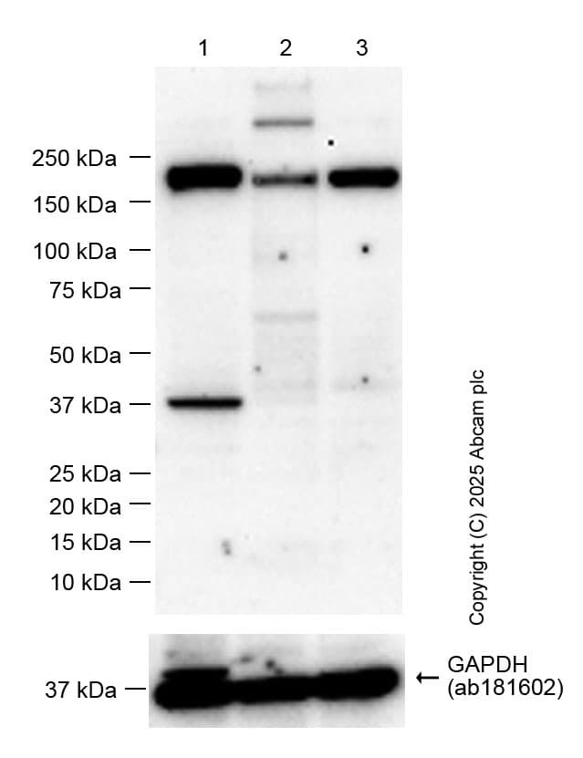 Anti-Mannose Receptor antibody [EPR25215-277](AB300621)