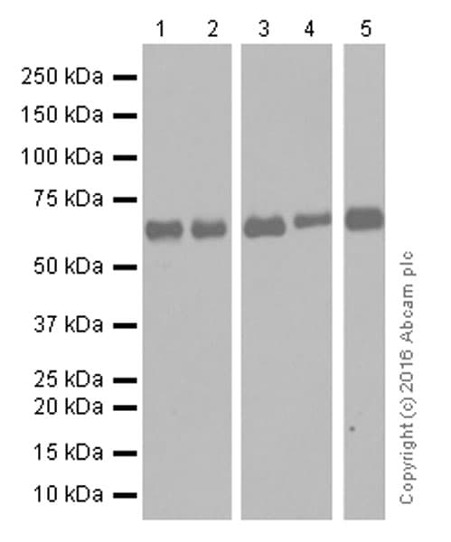 Anti-MMP14 antibody [EP1264Y](AB51074)