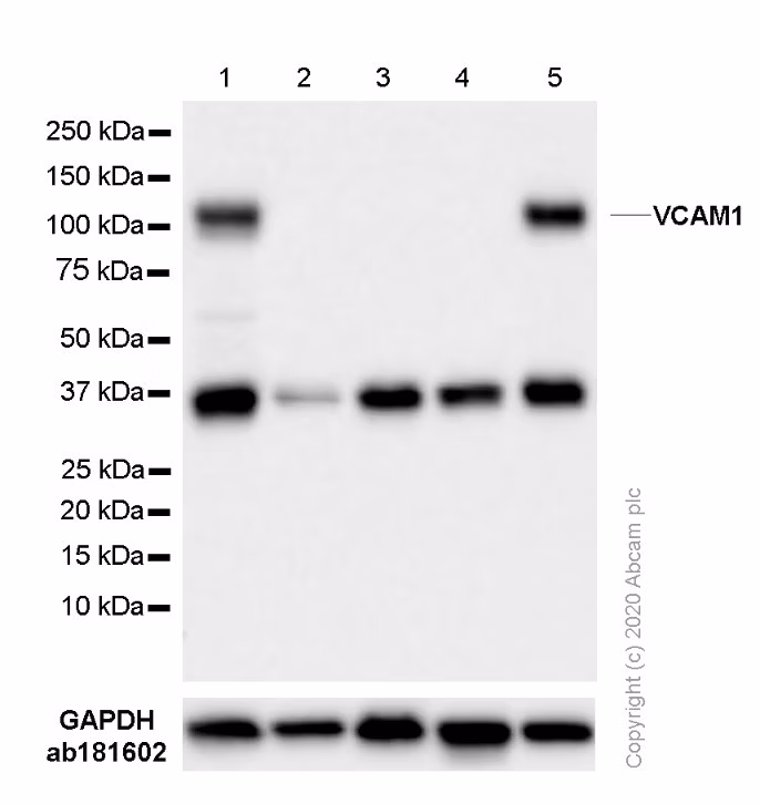 Western blot - Anti-VCAM1 antibody [EPR5047] (ab134047) at 1/1000 dilution. Blocking/Diluting buffer: 5% NFDM/TBST