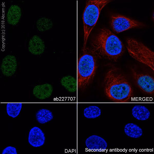 Western blot of SK-OV-3 and human kidney tissue lysates probed with anti-PAX8 antibody.