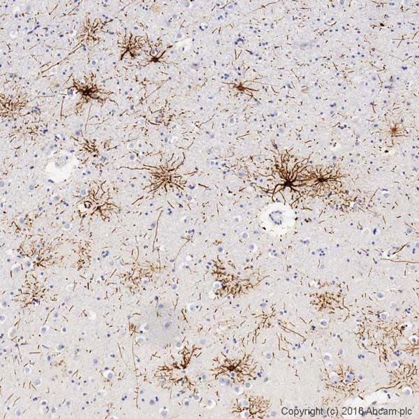 GFAP staining in formalin-fixed, paraffin-embedded normal human hippocampus tissue, IHC on Leica Bond™ system, standard protocol F, clear results.