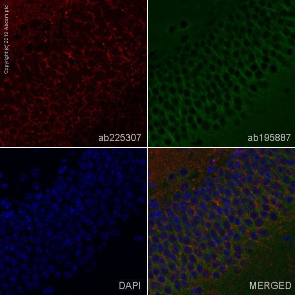 Alexa Fluor® 647 Anti-BACE1 antibody [EPR19523](AB225307)