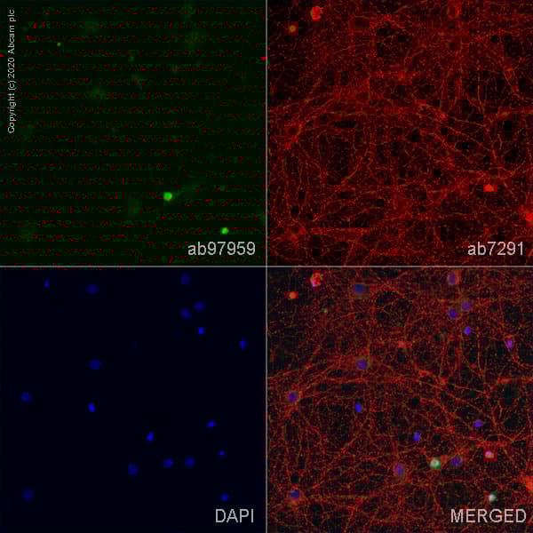 Anti-SOX2 antibody(ab97959)