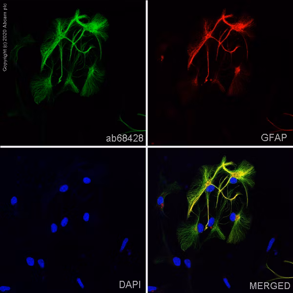 GFAP staining in formalin-fixed, paraffin-embedded normal human hippocampus tissue, IHC on Leica Bond™ system, standard protocol F, clear results.