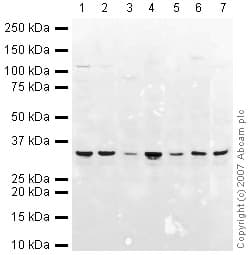 Anti-VDAC1/Porin + VDAC2 + VDAC3 antibody – Mitochondrial Loading Control(AB15895)