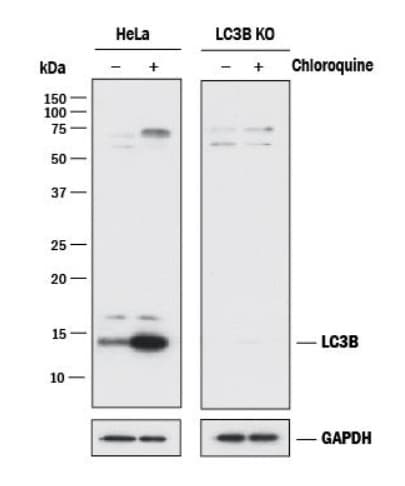 Anti-LC3B antibody - Autophagosome Marker(AB48394)
