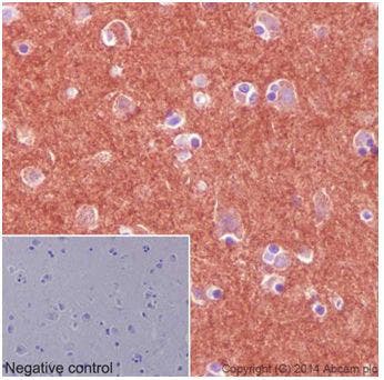 Immunohistochemical analysis of human cerebral cortex tissue labeling Pan Trk, counterstained with Hematoxylin.